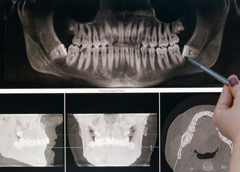 A missing tooth, replaced at the root