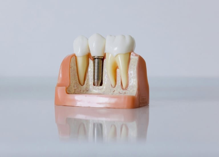 A missing tooth, replaced at the root