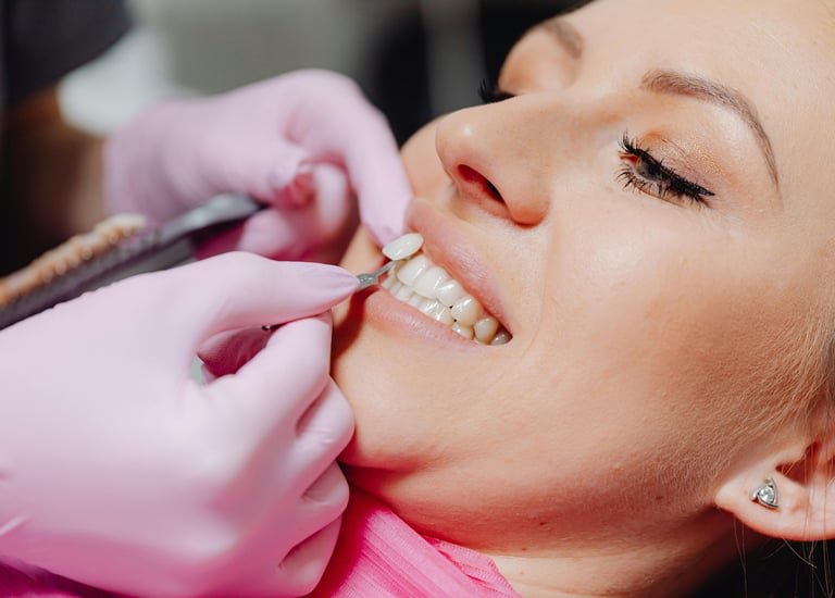 Whitening and veneers, measured not guessed